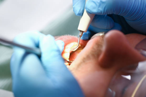 Best Urgent Care for Lost Fillings or Crowns in Port Edwards, WI