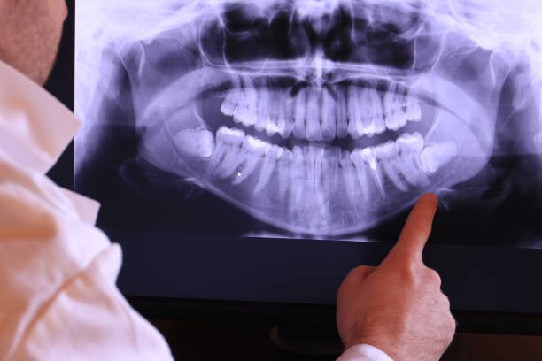 Best Emergency Tooth Extraction in Port Edwards, WI